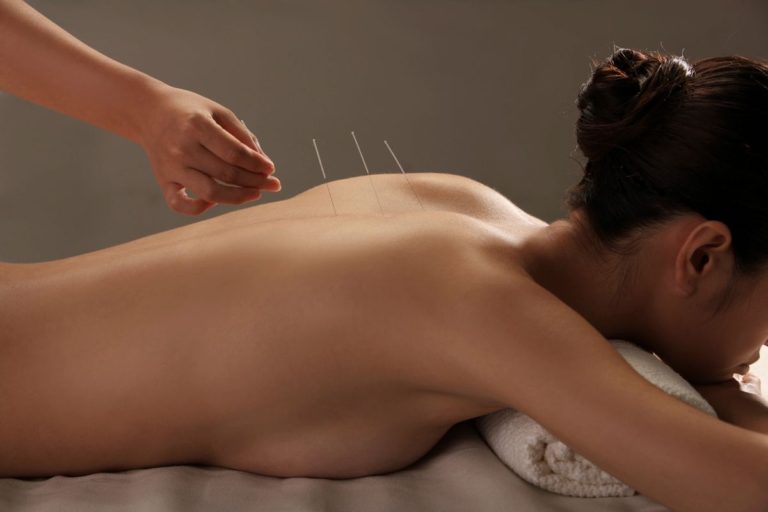 Wellness acupuncture
